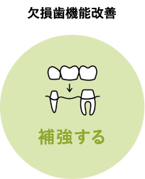 欠損歯機能改善：補強する